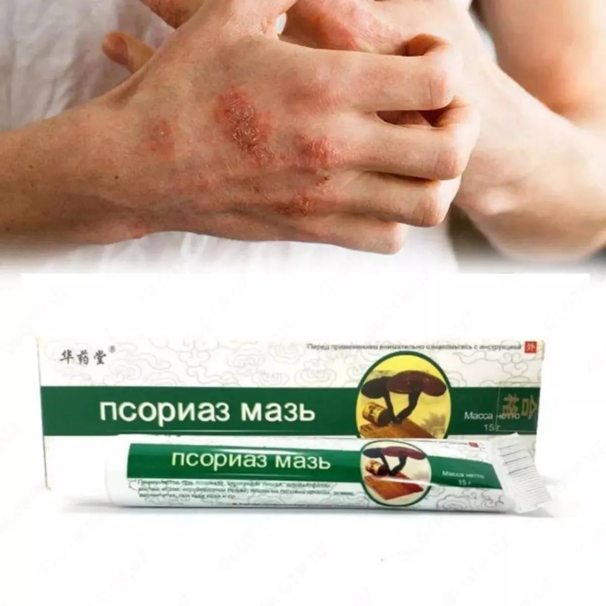🔥 PSORIAZ MAZ — TERI MUAMMOLARIGA YORDAM!